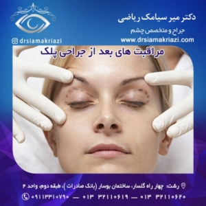مراقبت های بعد از جراحی پلک + دکتر سیامک ریاضی